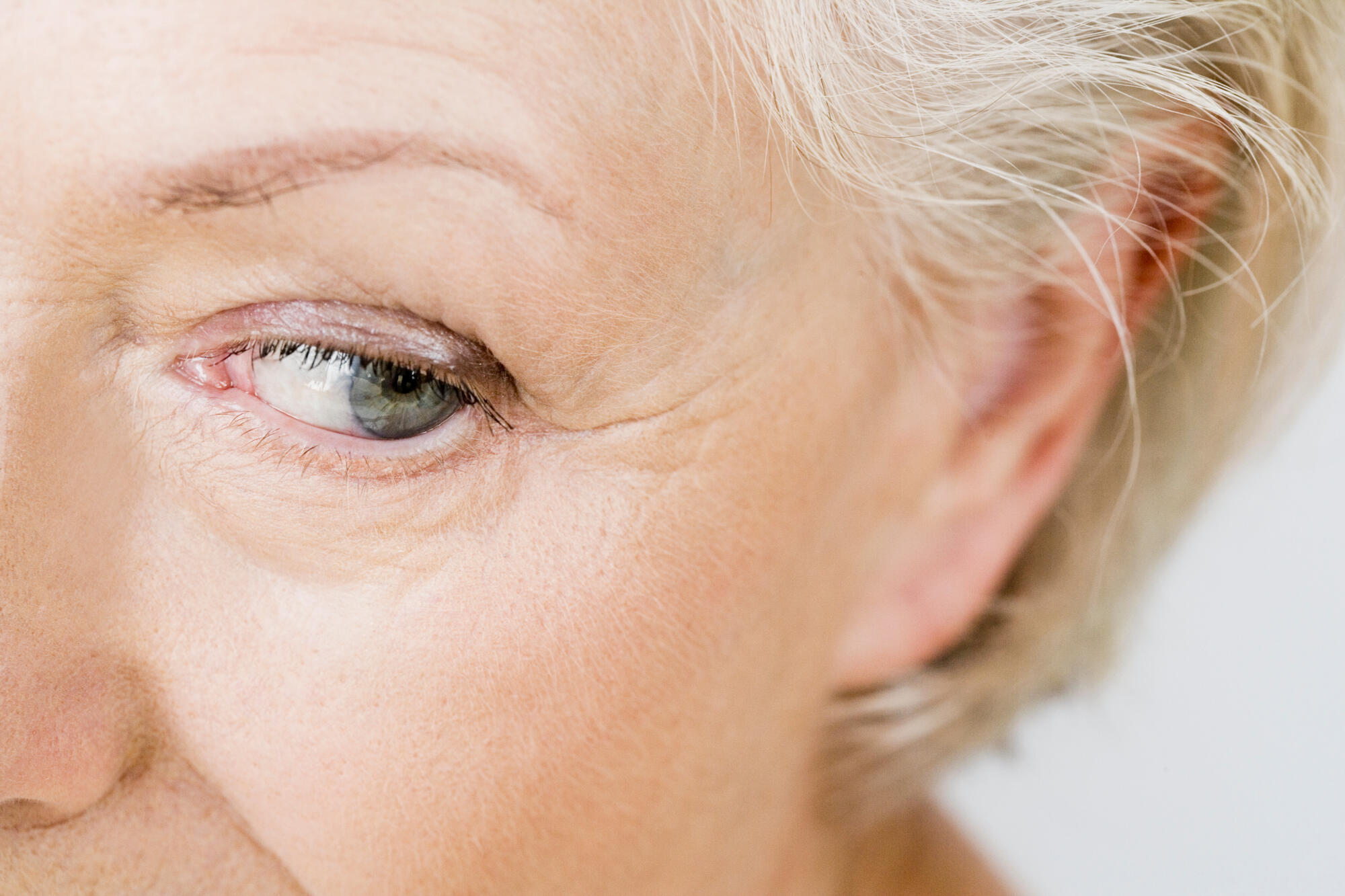 Dry Eye Vision Loss: What Seniors in Marysville Should Know